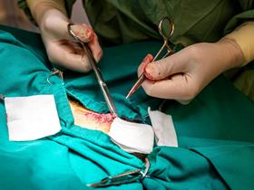 Surgery - Surgery in our practice